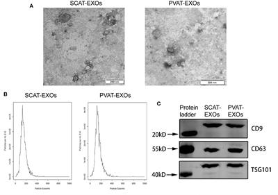 Perivascular Adipose-Derived Exosomes Reduce Foam Cell Formation by Regulating Expression of Cholesterol Transporters